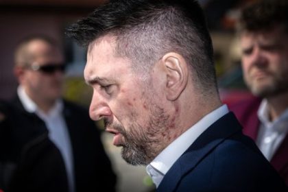 novinkovy filter minister takac je stelesnenim nepripravenosti slovenska na novy svet